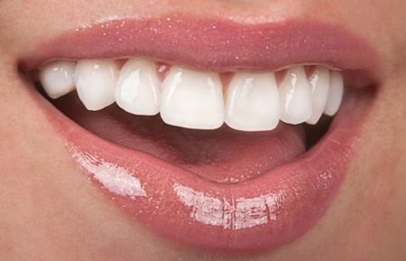 white teeth